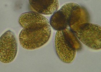 Gruppo di cellule di Ostreopsis ovata