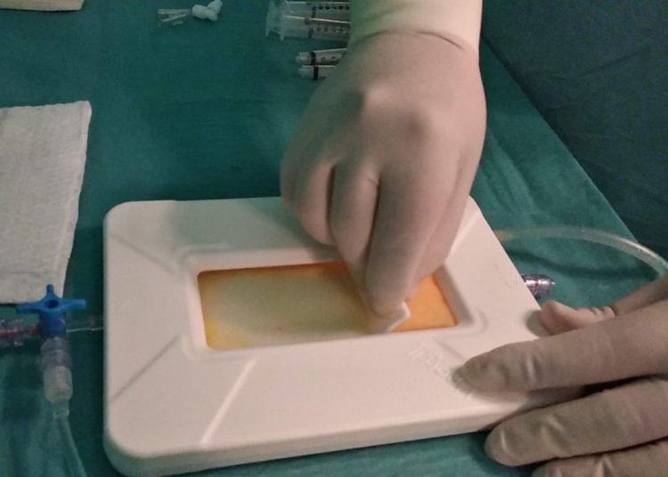 La medicina rigenerativa approda al Poliambulatorio Mesal 5 Mesal 2 1